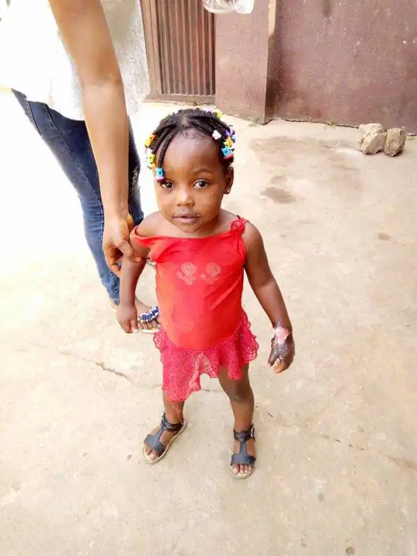 See what a mother did to her child to stop her from sucking her fingers (Photos)
